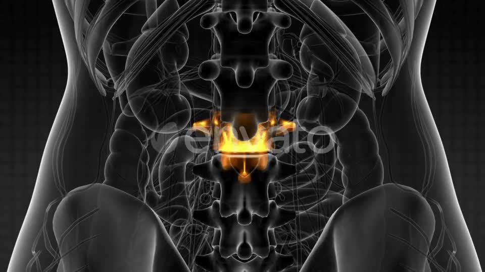 Backache in Back Bones - Download Videohive 21915232