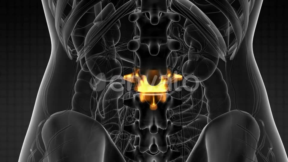 Backache in Back Bones - Download Videohive 21915232