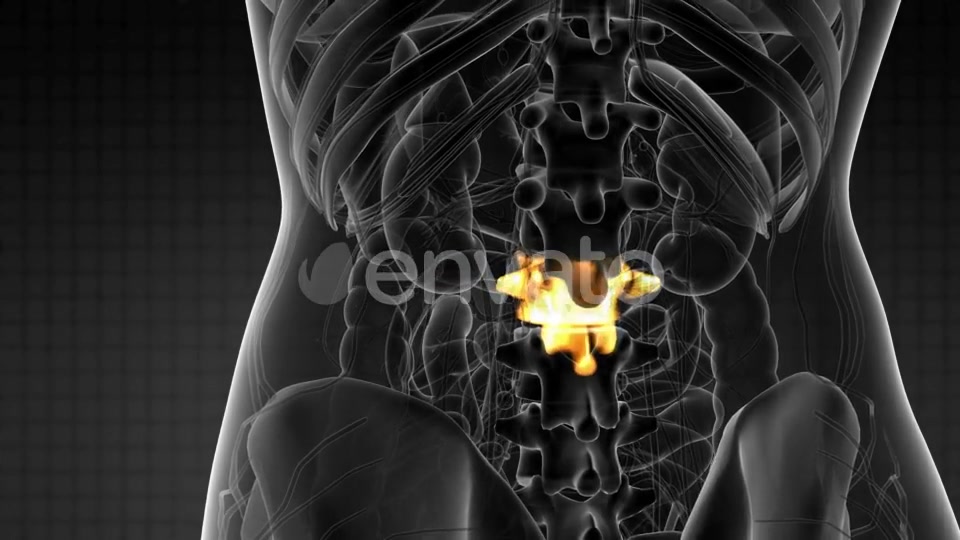 Backache in Back Bones - Download Videohive 21915232