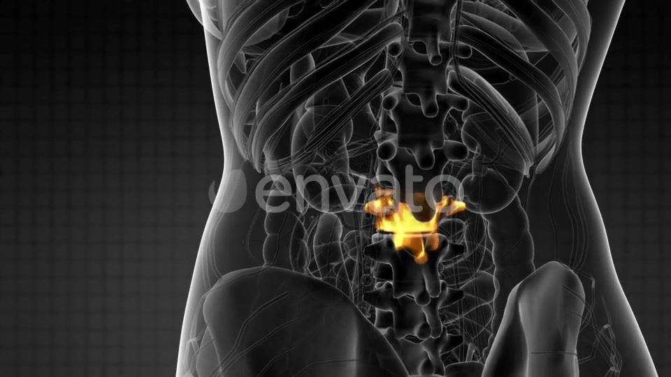 Backache in Back Bones - Download Videohive 21915232