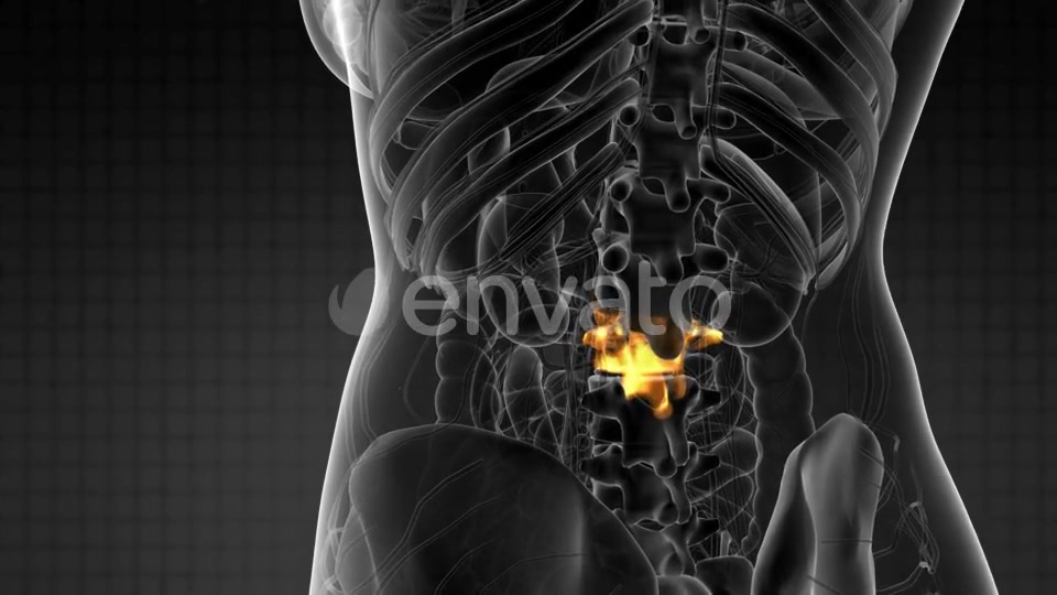 Backache in Back Bones - Download Videohive 21915232