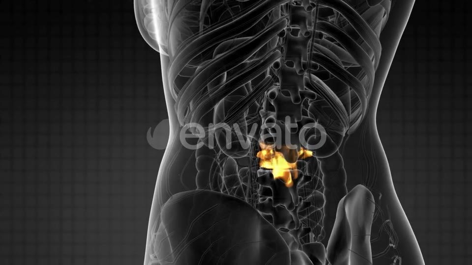 Backache in Back Bones - Download Videohive 21915232