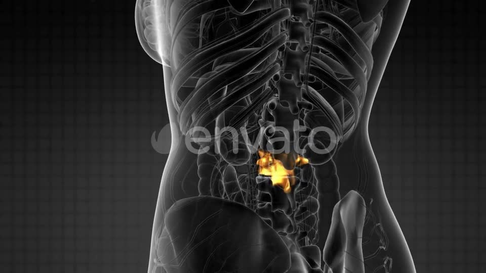 Backache in Back Bones - Download Videohive 21915232