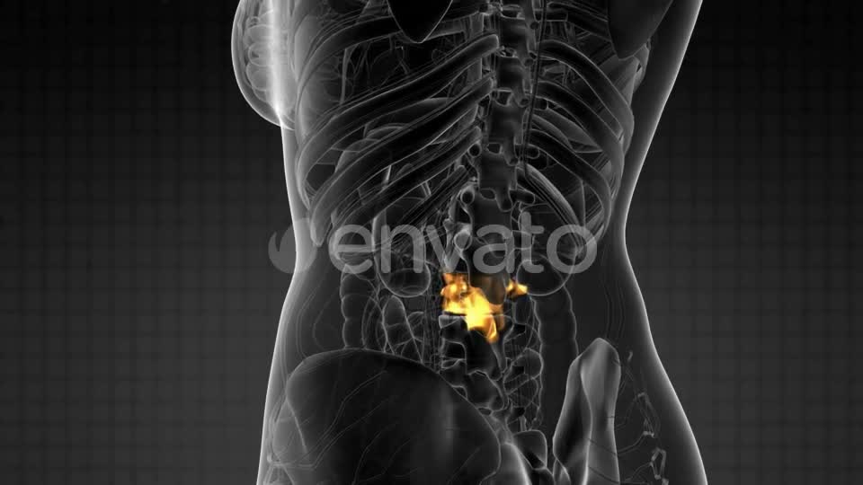 Backache in Back Bones - Download Videohive 21915232