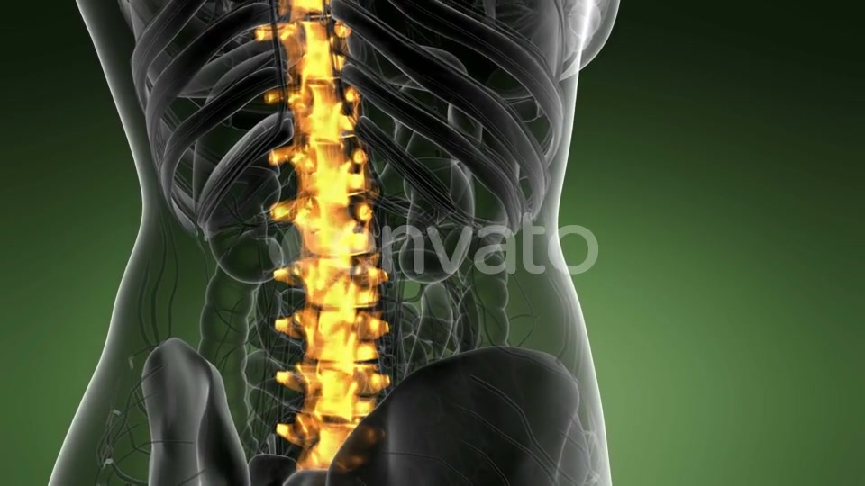 Backache in Back Bones - Download Videohive 21978273