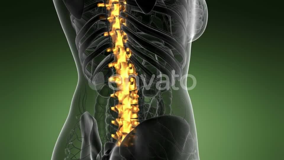 Backache in Back Bones - Download Videohive 21978273