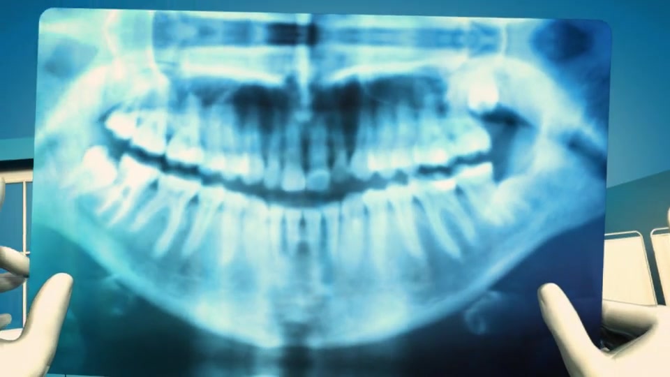 dental intro after effect free download