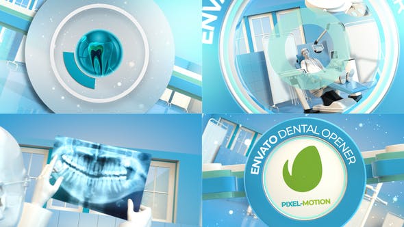 Dental Opener - 35173342 Videohive Download