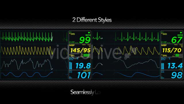 EKG Display Monitor - Download Videohive 10623371