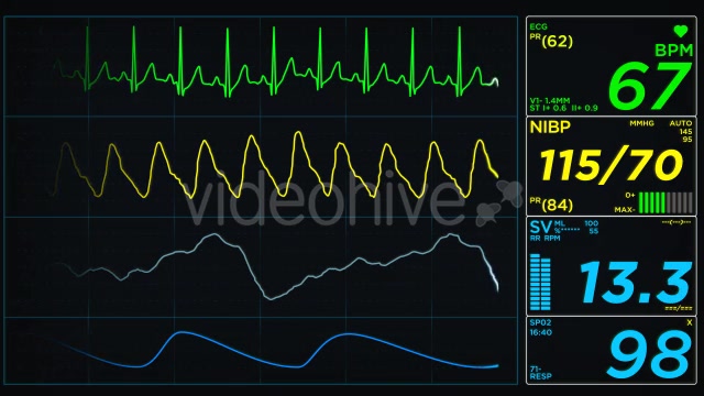 EKG Display Monitor - Download Videohive 10623371