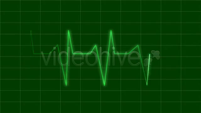 EKG - Download Videohive 73163