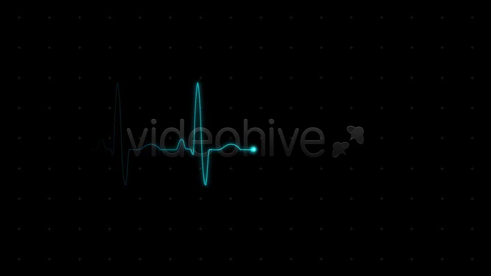 EKG (Heartbeat Monitor Electrocardiogram) - Download Videohive 615689