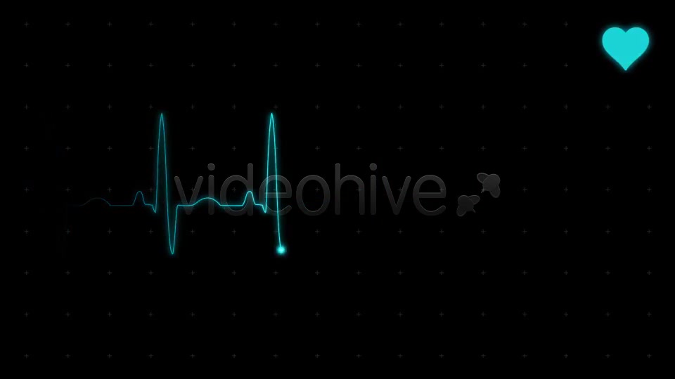 EKG (Heartbeat Monitor Electrocardiogram) - Download Videohive 615689