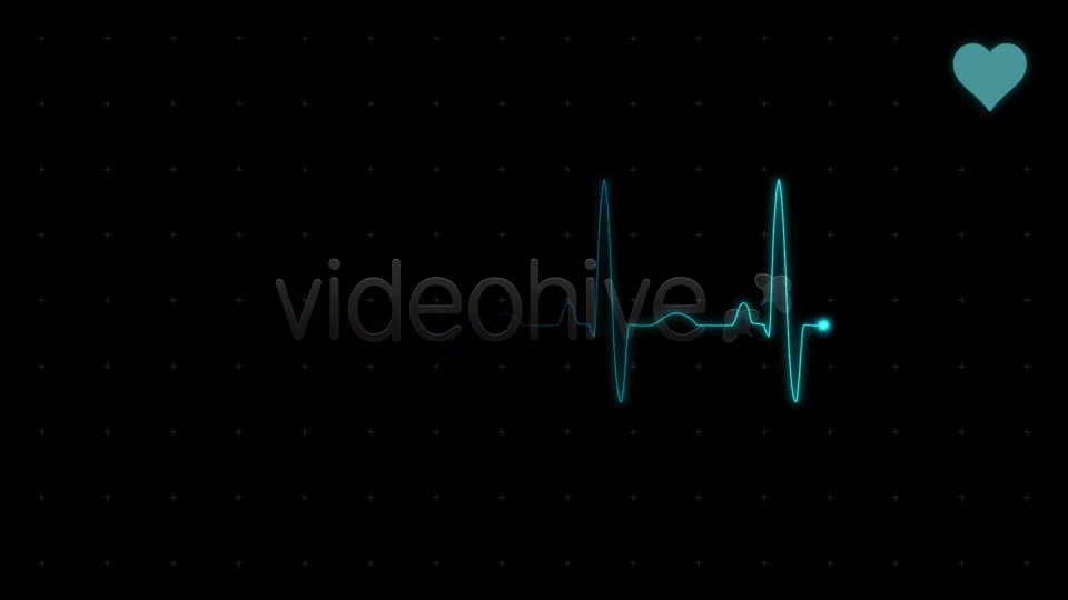 EKG (Heartbeat Monitor Electrocardiogram) - Download Videohive 615689