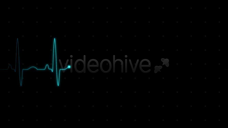 EKG (Heartbeat Monitor Electrocardiogram) - Download Videohive 615689
