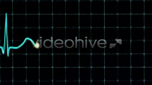 Electrocardiogram  Videohive 157556 Stock Footage Image 2