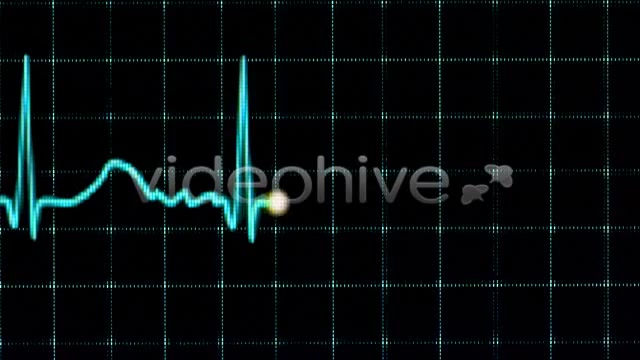 Electrocardiogram  Videohive 157556 Stock Footage Image 3