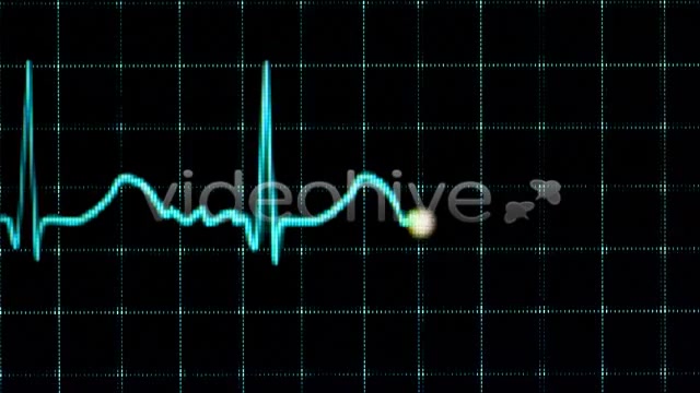 Electrocardiogram  Videohive 157556 Stock Footage Image 4