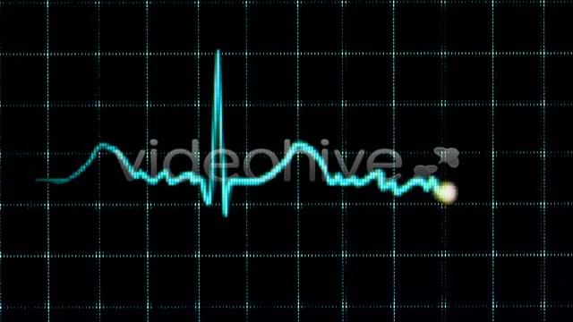 Electrocardiogram  Videohive 157556 Stock Footage Image 5