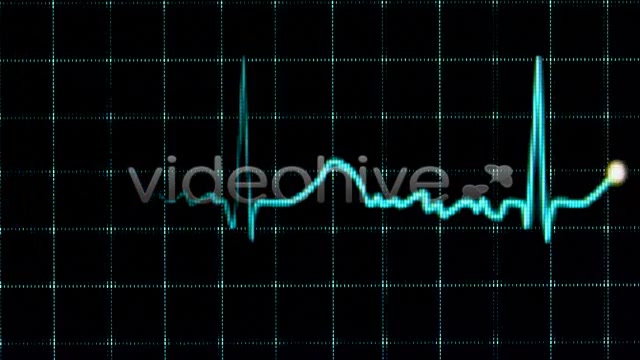 Electrocardiogram  Videohive 157556 Stock Footage Image 6
