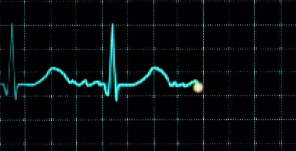 Electrocardiogram  - 157556 Videohive Download