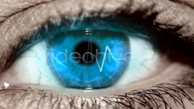 Eye ElectroCardiogram  Videohive 557676 Stock Footage Image 9