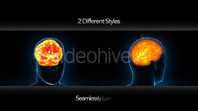 Human Brain X Ray - Download Videohive 11532795