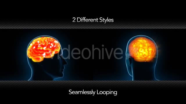 Human Brain X Ray - Download Videohive 11532795