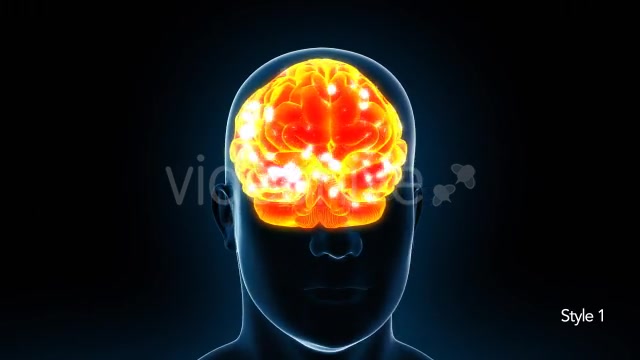 Human Brain X Ray - Download Videohive 11532795