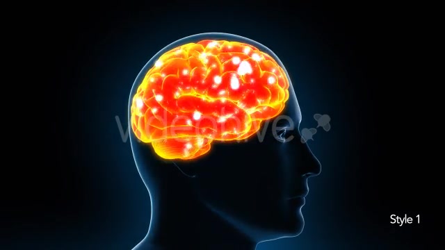 Human Brain X Ray - Download Videohive 11532795