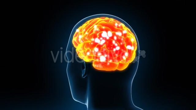 Human Brain X Ray - Download Videohive 11532795