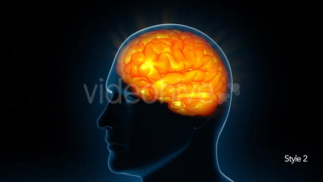 Human Brain X Ray - Download Videohive 11532795