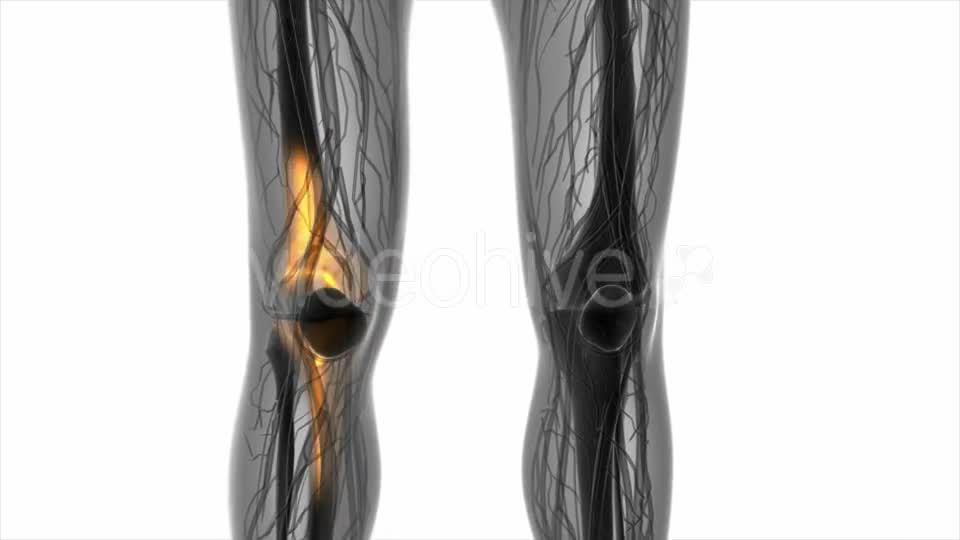 Knee Bones Anatomy - Download Videohive 20569177