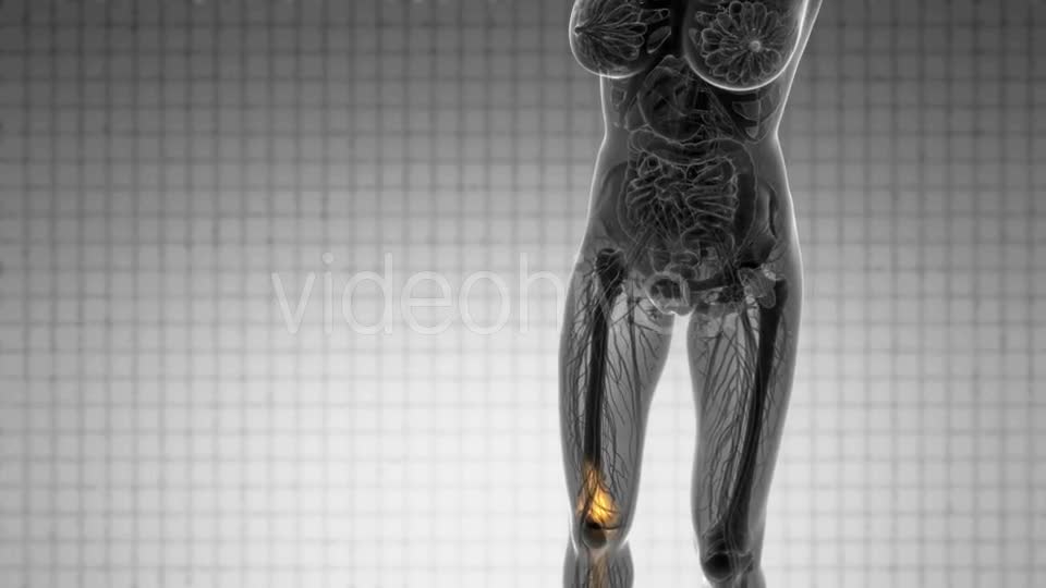 Knee Bones Anatomy - Download Videohive 20854616