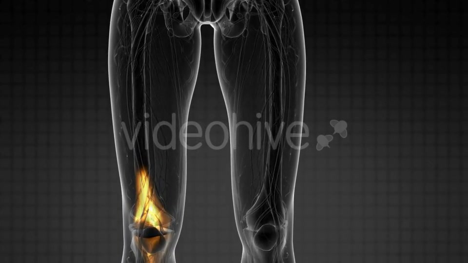 Knee Bones Anatomy - Download Videohive 21297551