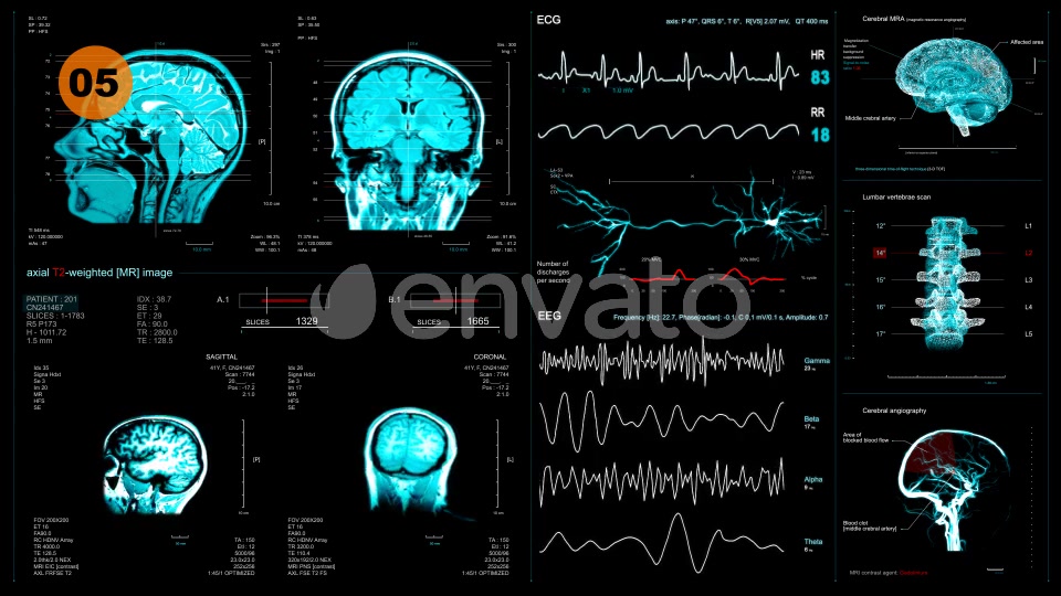 Medical Pack 18 Screens (300+ elements) Videohive 31030245 After Effects Image 10