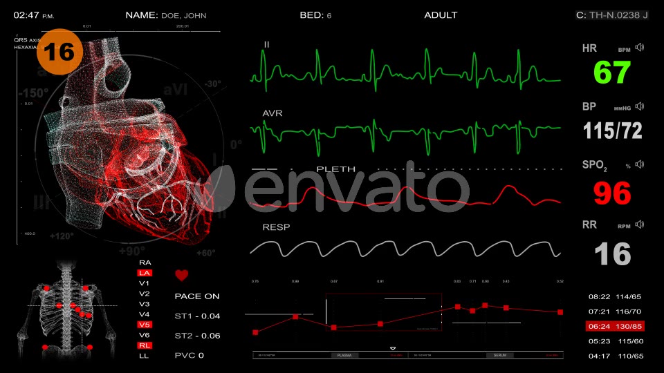Medical Pack 18 Screens (300+ elements) Videohive 31030245 After Effects Image 3