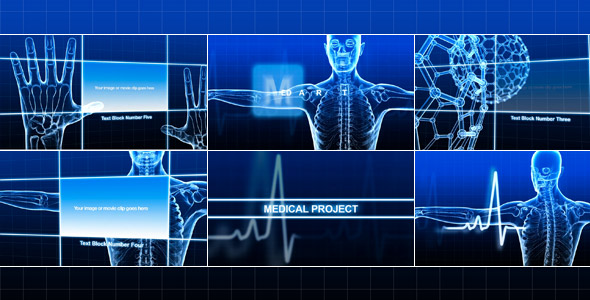 Medical Project - Download Videohive 236064