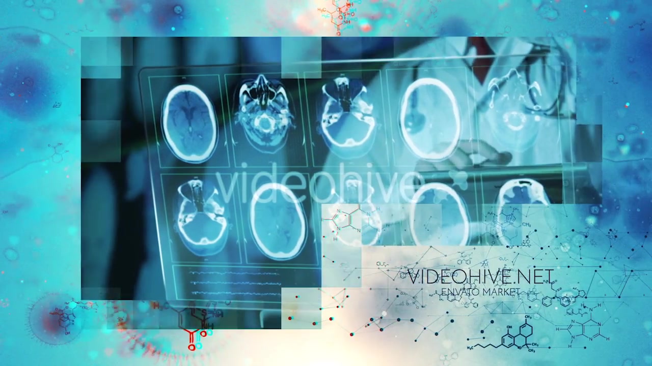 Microscope Video Slideshow Videohive 21147569 After Effects Image 11