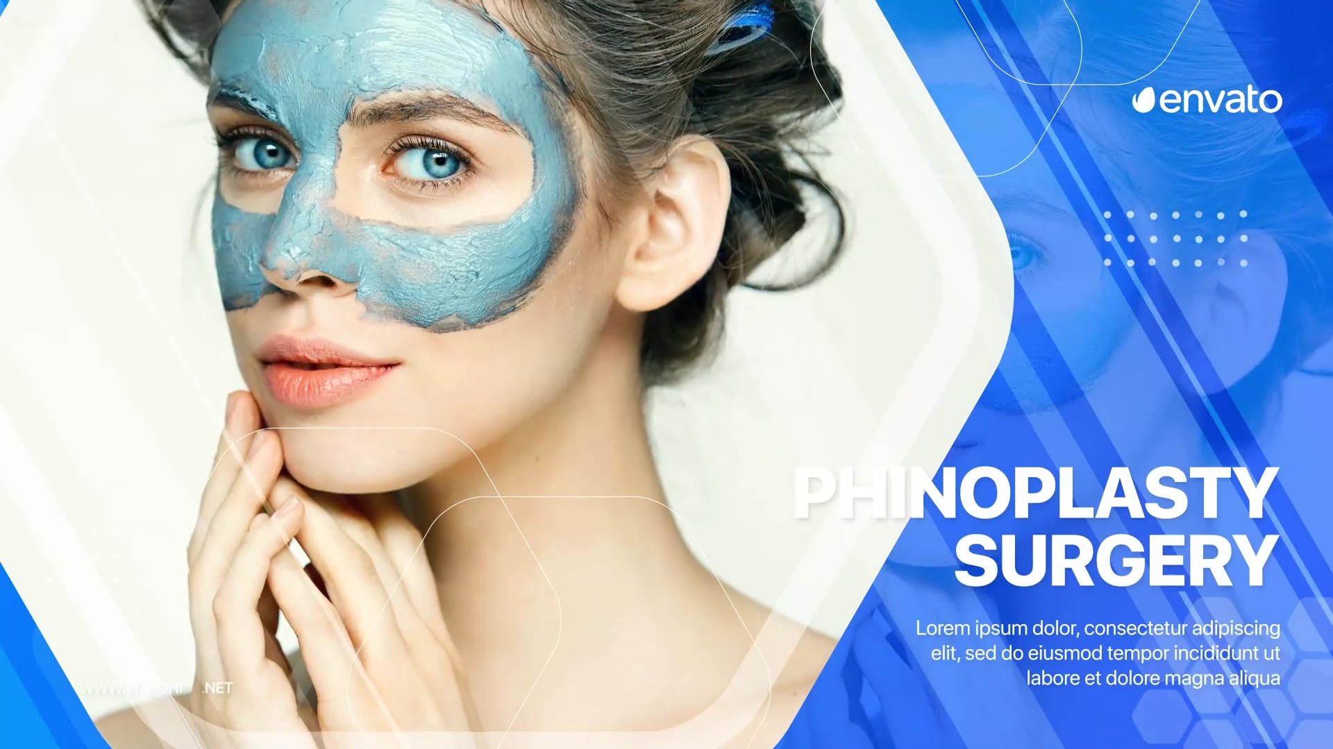 Plastic Surgery Promo Videohive 28771949 After Effects Image 10
