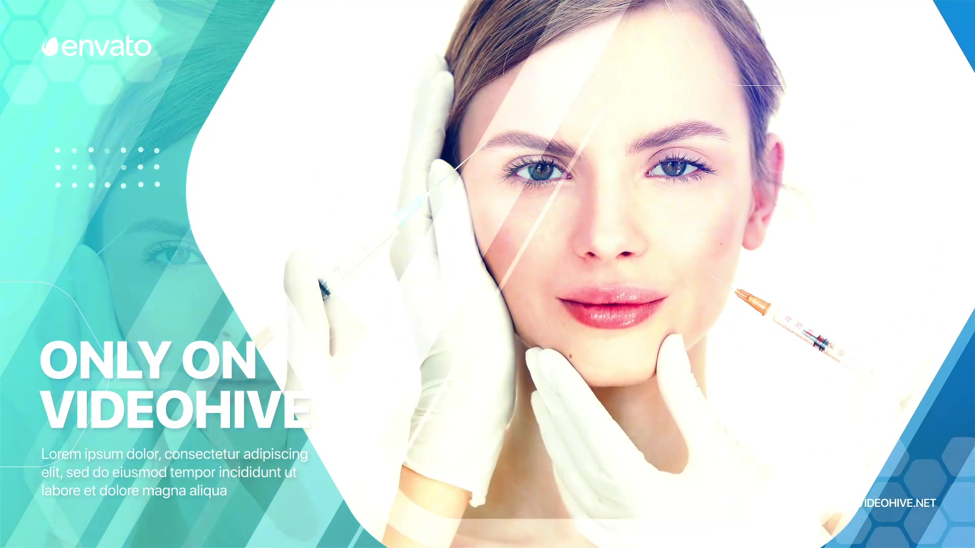 Plastic Surgery Promo Videohive 28771949 After Effects Image 6