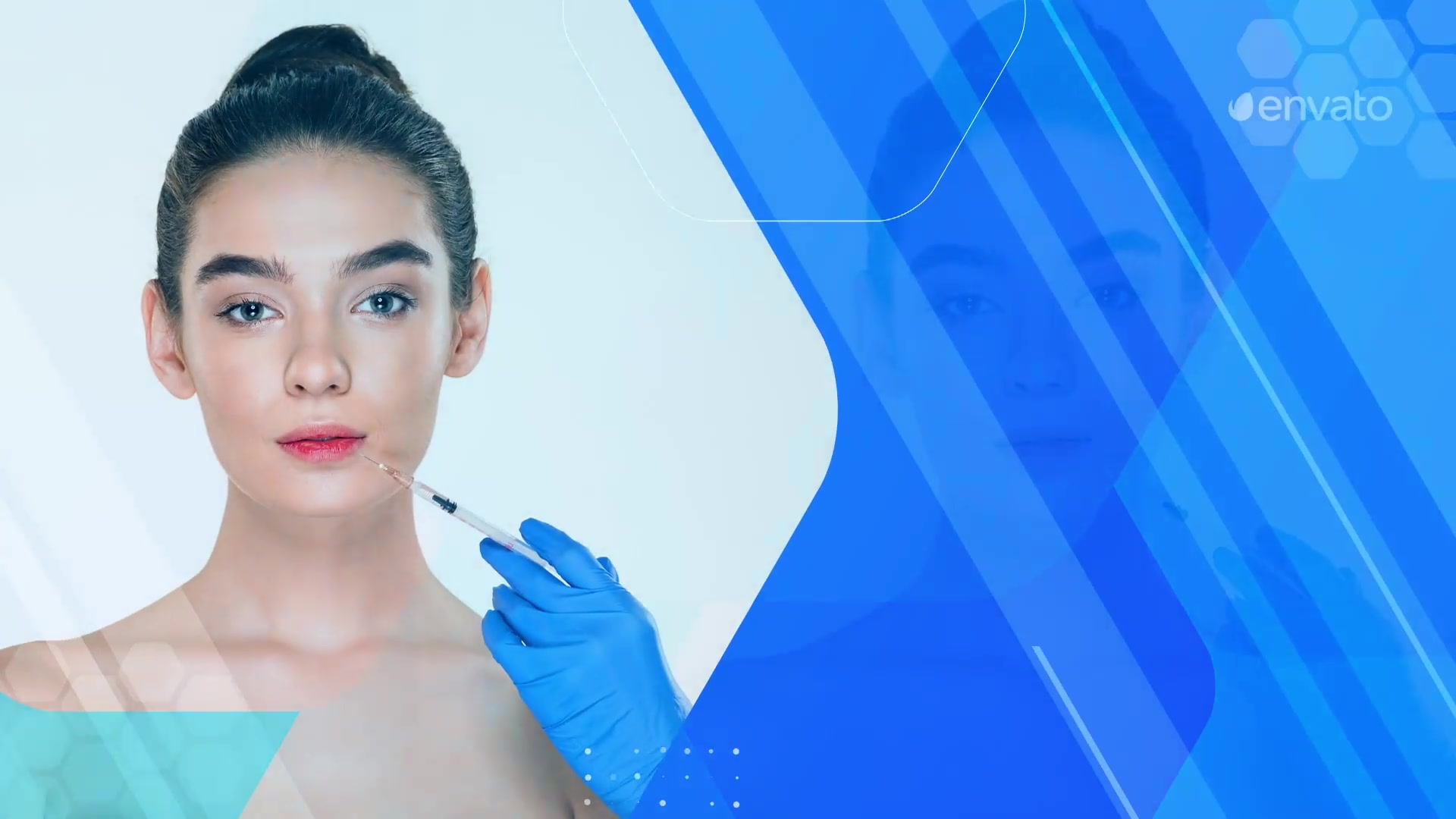 Plastic Surgery Promo Videohive 28771949 After Effects Image 8