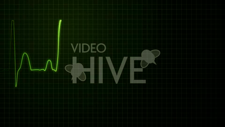 Realistic Heartbeat / EKG Display - Download Videohive 61671