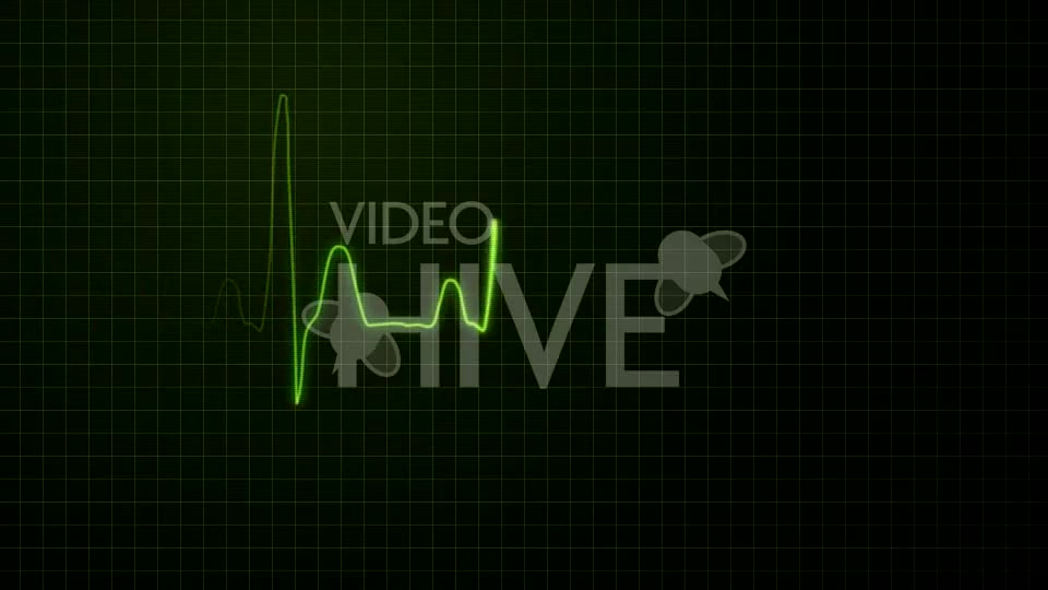 Realistic Heartbeat / EKG Display - Download Videohive 61671