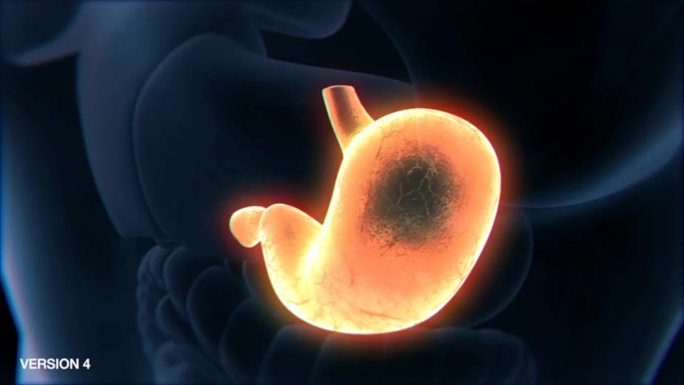 Stomach Elements 2 Videohive 33200534 After Effects Image 10
