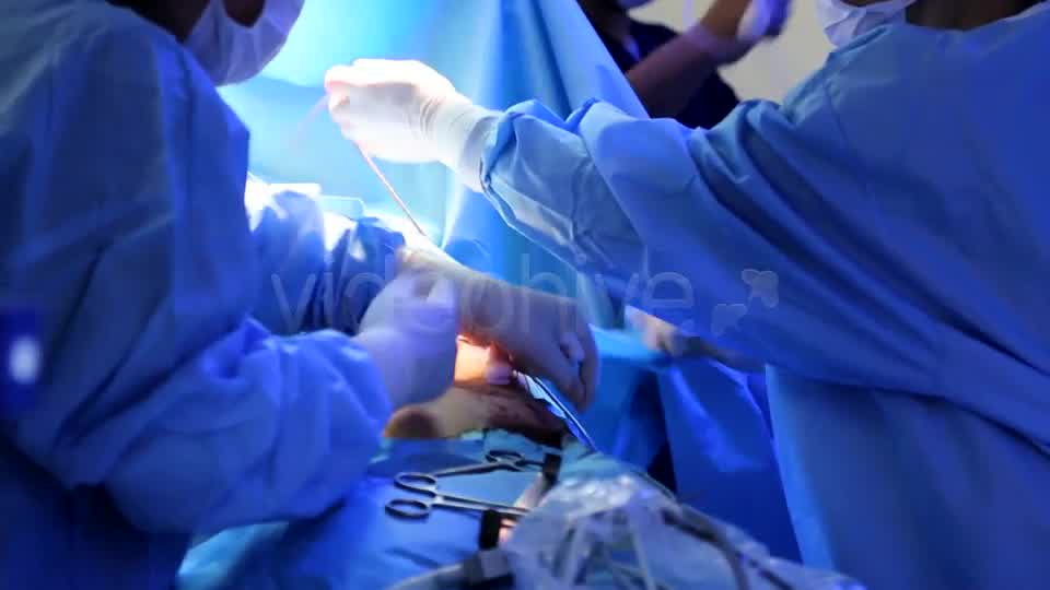 Surgery  Videohive 7666714 Stock Footage Image 10