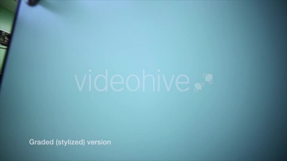 Surgery in Hospital 2  Videohive 12776773 Stock Footage Image 1