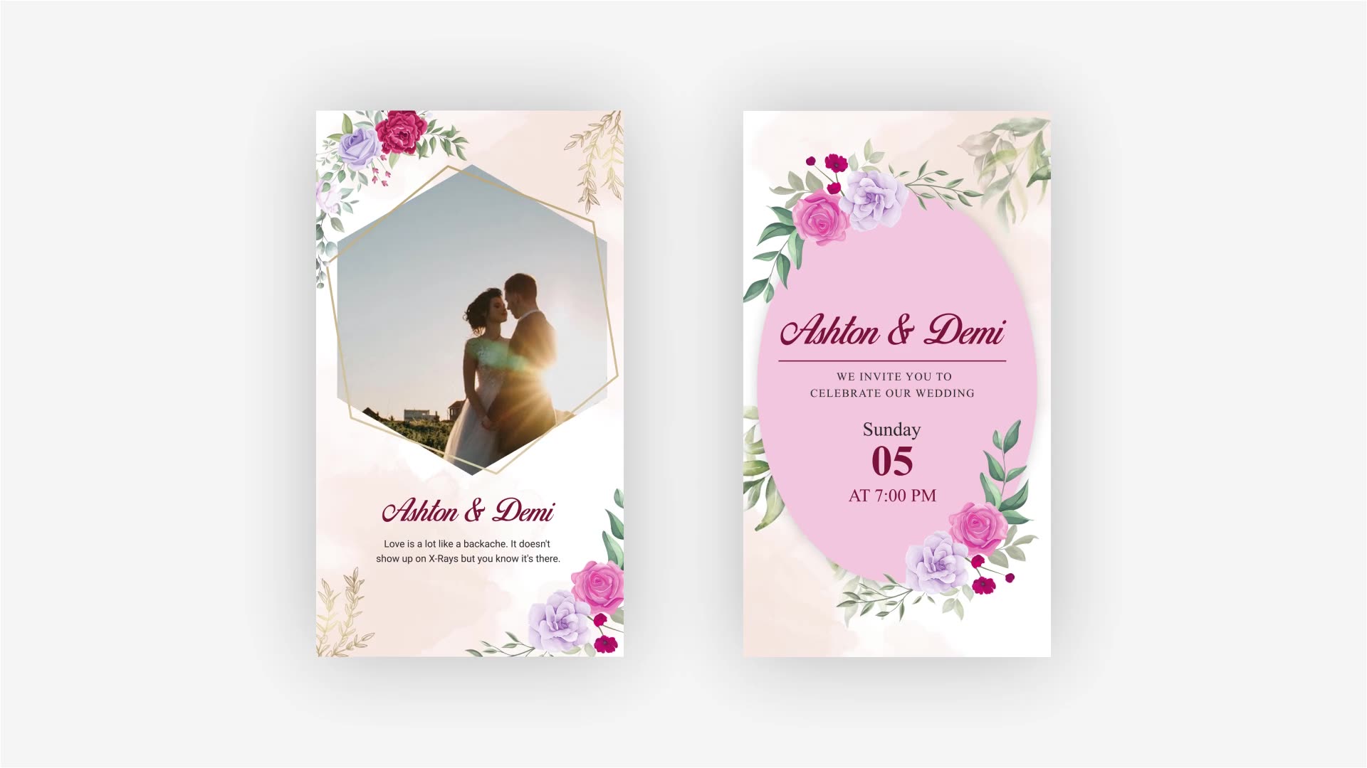 Wedding Instagram Story Pack Videohive 34599391 After Effects Image 3