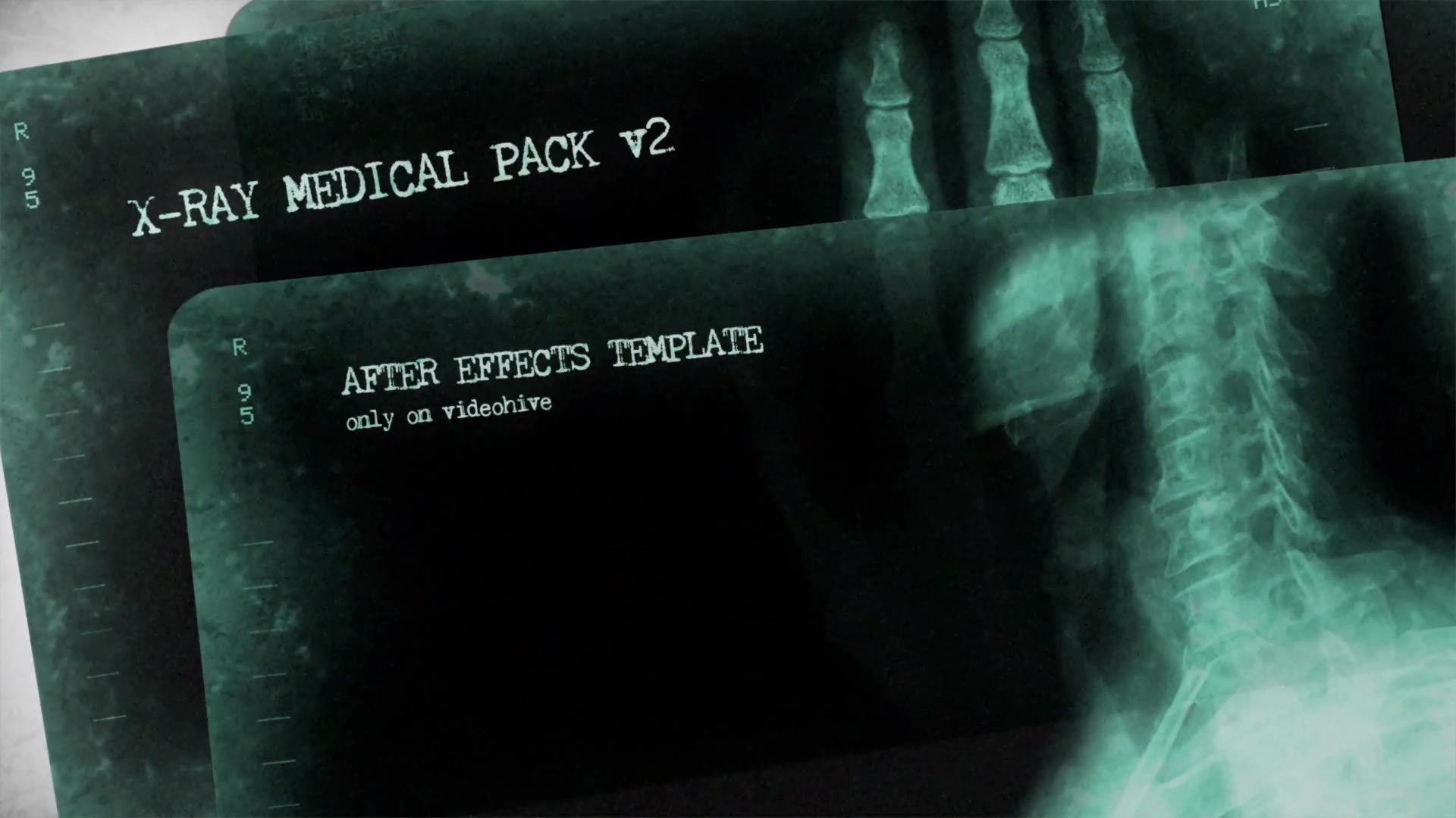X Ray Medical Pack v2 Videohive 11515778 After Effects Image 2