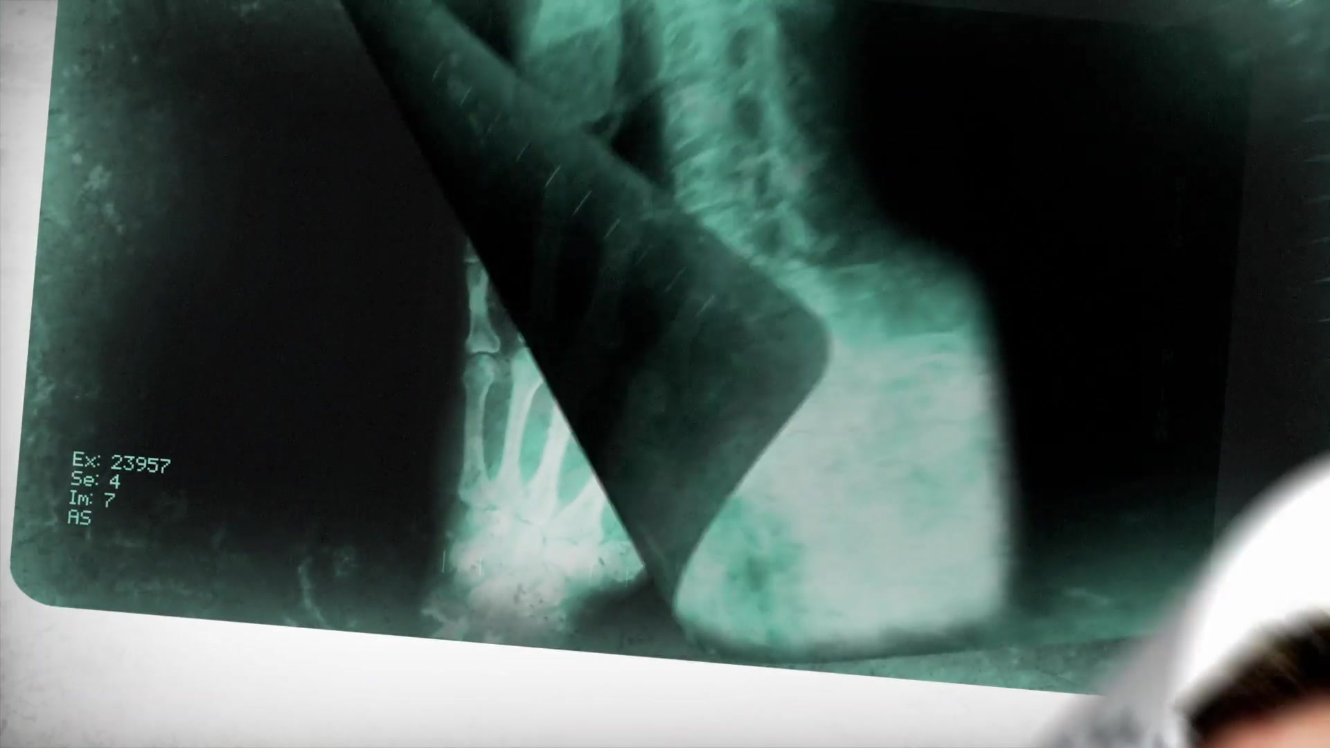 X Ray Medical Pack v2 Videohive 11515778 After Effects Image 3